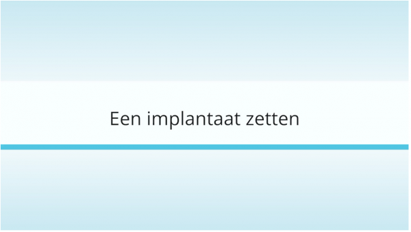Video, implantaat zetten Video Implantaat zetten